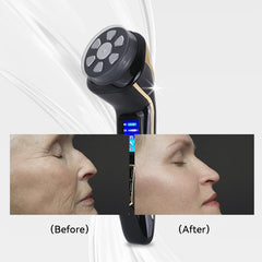 FREYARA HIFU - FacialDefy 2.0, przenośne i podręczne urządzenie HIFU 4w1 z mikroogniskowanymi ultradźwiękami, ulepszona moc, szybszy lifting, widoczne rezultaty