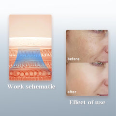 Urządzenie do Twarzy 3w1 Anti-Aging FREYARA – Nano Spray z Mikroprądami MIFR i Niebieskim Światłem LED | Głębokie Nawilżanie, Lifting, Redukcja Trądziku i Modelowanie Konturu Twarzy