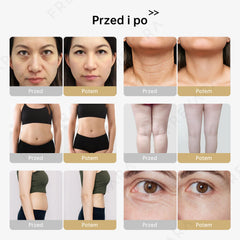 40K 4w1 RF Ultradzwiękowa Kawitacja Vacuum, Urządzenie do Liposukcji i Wyszczuplania, Twarz, Ramiona, Talię, Brzuch, Nogi