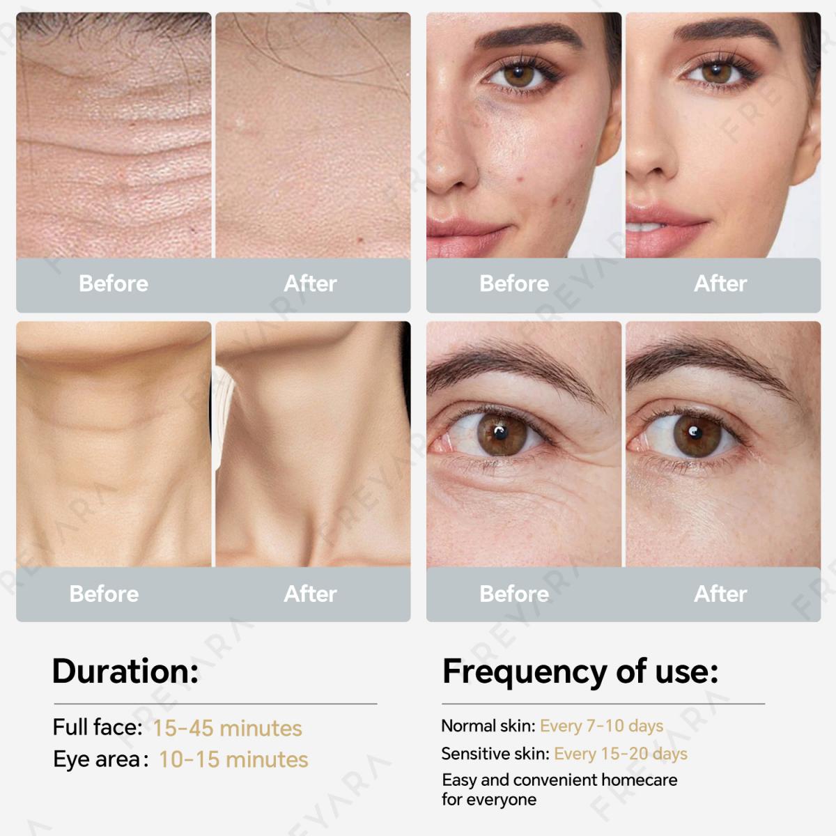 FREYARA HIFU - FacialDefy 3.0, Profesjonalne urządzenie HIFU RF z ultradźwiękami do liftingu twarzy, przeciwstarzeniowe i redukujące zmarszczki