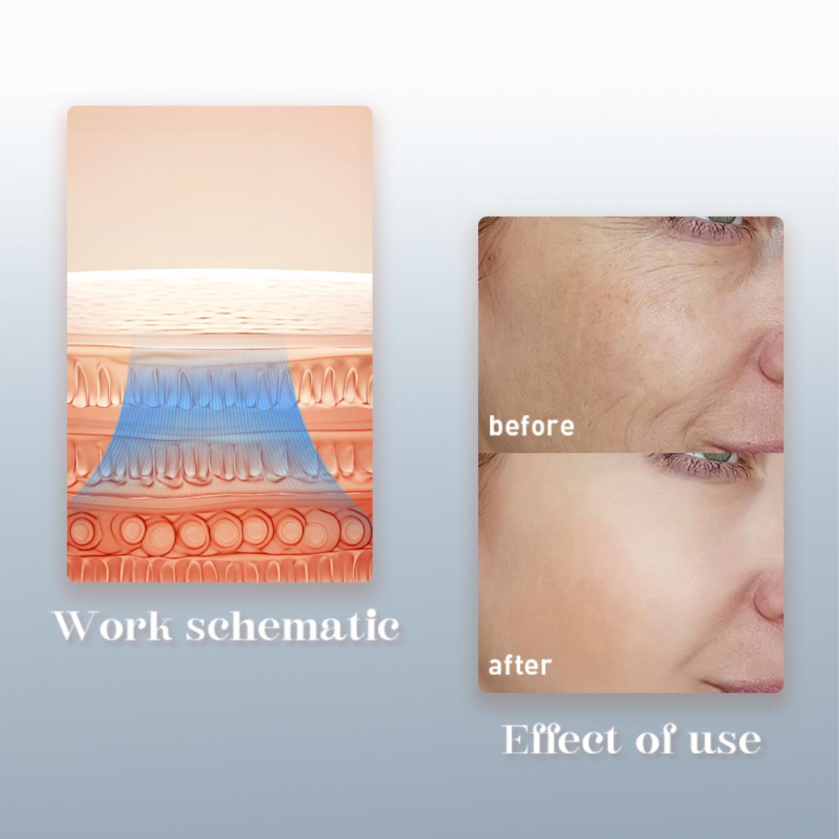 Urządzenie do Twarzy 3w1 Anti-Aging FREYARA – Nano Spray z Mikroprądami MIFR i Niebieskim Światłem LED | Głębokie Nawilżanie, Lifting, Redukcja Trądziku i Modelowanie Konturu Twarzy